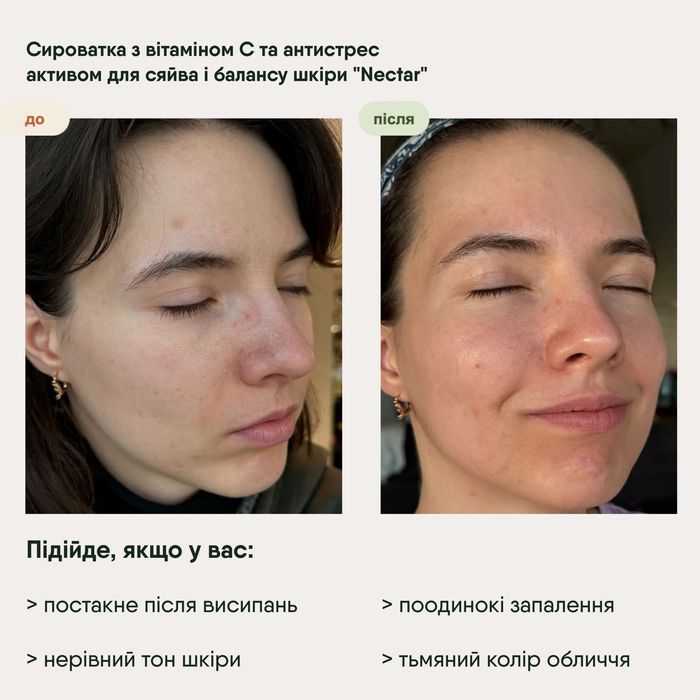 Сироватка з вітаміном С та антистрес активом "Nectar" 11076 Пташкин Сад